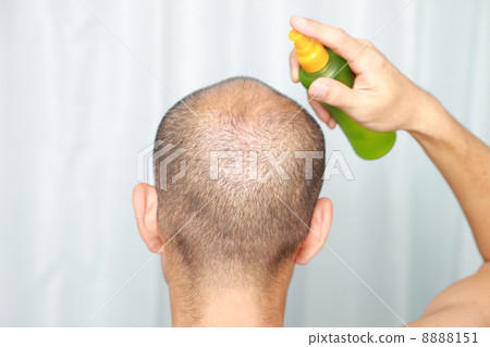 hair tonic, bald, loss of hair