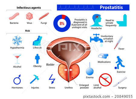 插图素材: prostatitis. benign enlargement of the prostate