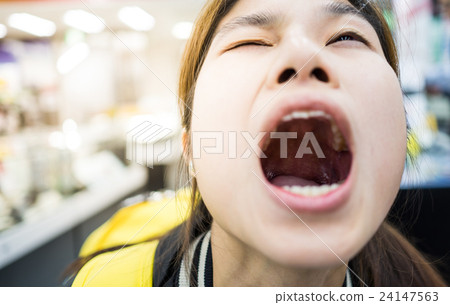 图库照片: asian girl opening mouth wide