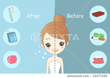 before after图片,before和after 插图素材: woman teeth before and after