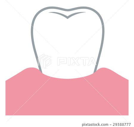 插图素材 牙龈下垂的牙周病