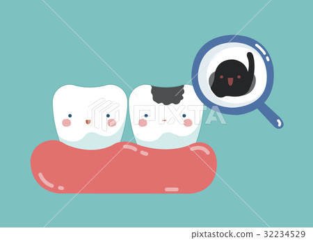 插图素材: decayed tooth and bacteria , tooth and teeth