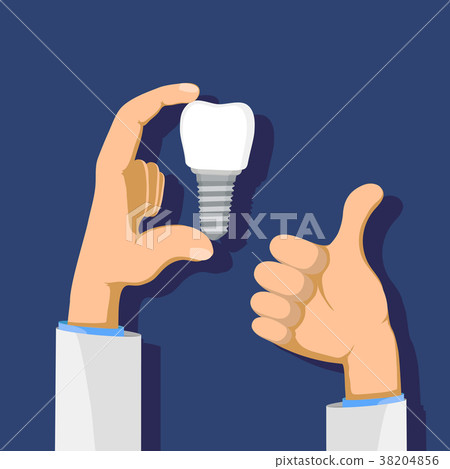 图库插图: dental implant in hand