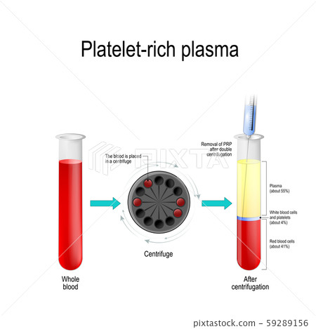 Platelet Rich Plasma Autologous Conditioned Stock Illustration