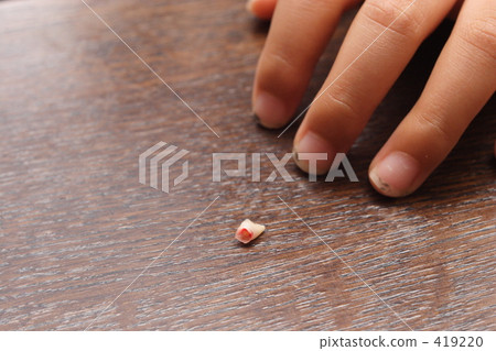 我的寶寶牙齒被拉出來了。 我的寶寶牙齒被拉出來了。 419220