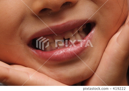 我的寶寶牙齒被拉出來了。 我的寶寶牙齒被拉出來了。 419222