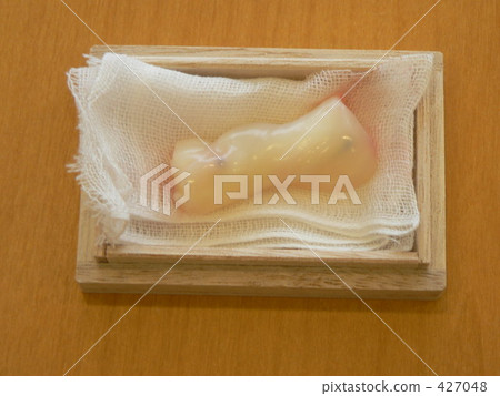 Umbilical cord Umbilical cord 427048