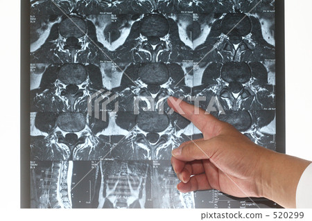 Medical MRI diagnosis 3 is here 520299