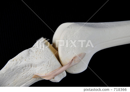 Bone model (knee part) 718366