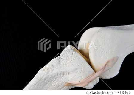 骨模型（膝蓋部分） 718367