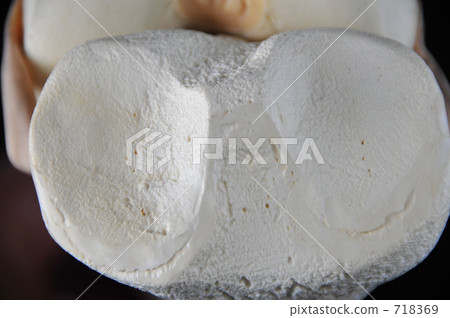 Bone model (knee part) 718369