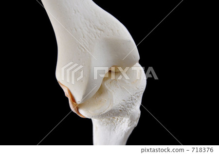 骨模型（膝蓋部分） 718376