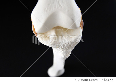 骨模型(膝蓋部分) 骨模型(膝蓋部分) 718377