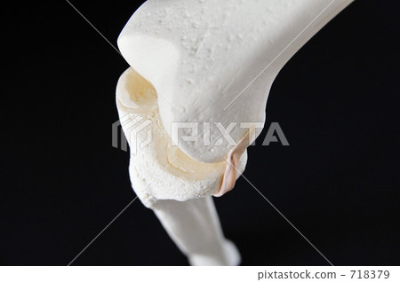 Bone model (knee part) 718379