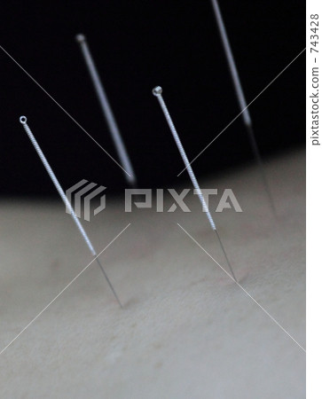 acupuncture and moxybustion 743428