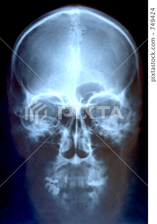 Skull taken with X-rays 749424