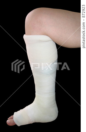 腿骨折斷和穿著演員黑色背景 872923