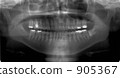 Panoramic radiograph Panoramic radiograph 905367