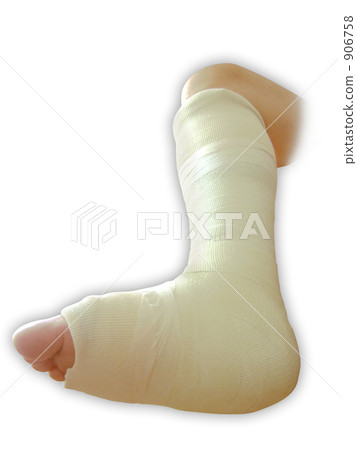 腳後面戴著骨折的石膏 906758