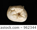 Extracted tooth 1 Extracted tooth 1 962344