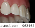 Dentition model (front teeth part) Dentition model (front teeth part) 962462