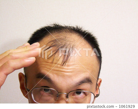 Wrinkle in thin hair - 7 1061929