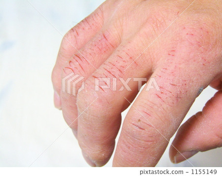 紅色盔甲的手4 1155149