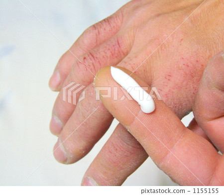 Hand roughness prevention - 1 Hand roughness prevention - 1 1155155