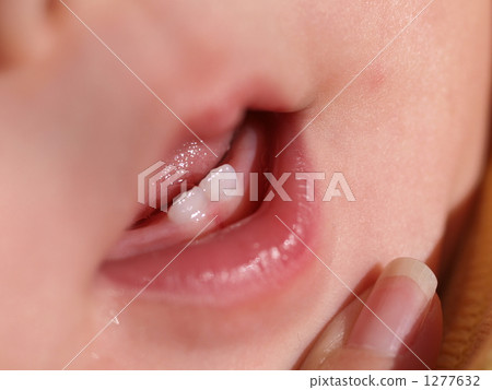 Milk teeth 1277632