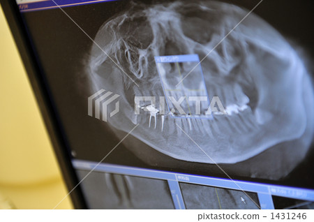 ct, examination, examining 1431246