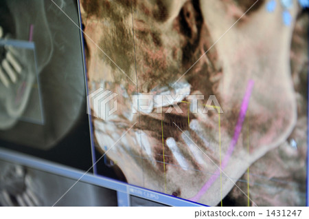 teeth, tooth, roentgen 1431247