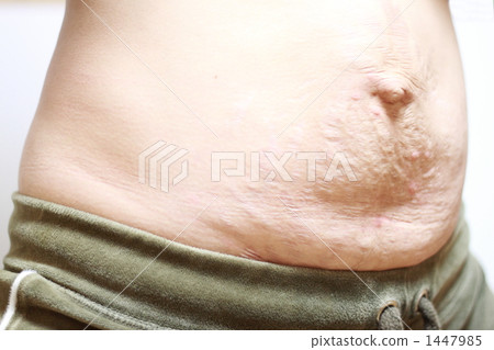 Pregnancy line Pregnancy line 1447985