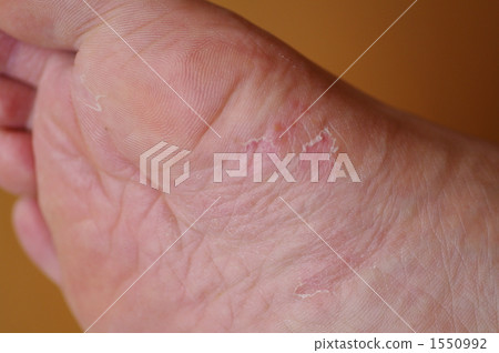 不衛生 骯髒的 不潔 1550992