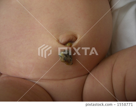 Baby with umbilical cord Baby with umbilical cord 1558771