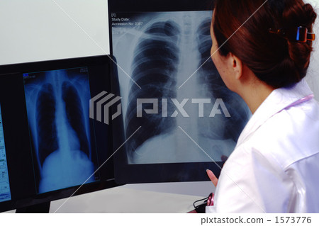 肺部 肺 牙齒矯正醫師 1573776