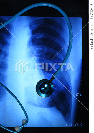 肺部 肺 膠卷 1573869