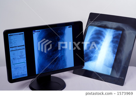x-ray, compare, comparison 1573969