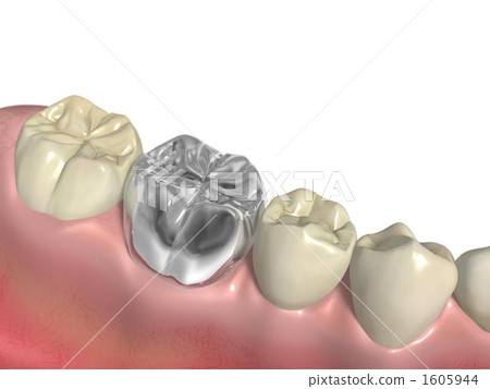 Silver teeth 1605944