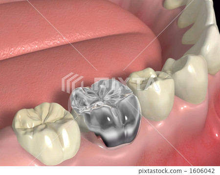 Silver teeth 1606042