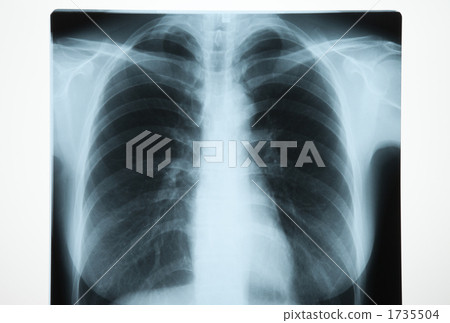 Roentgen Roentgen 1735504