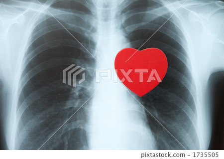 Roentgen and Heart 1735505