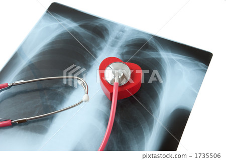Electrocardiogram and X-ray 1735506