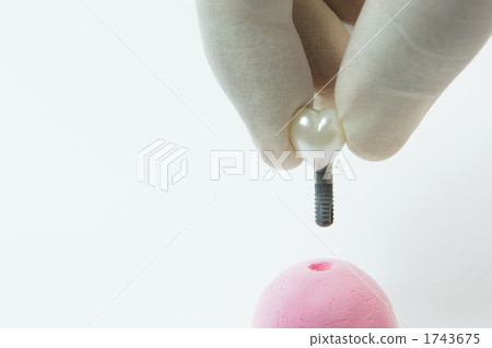 Dental Implant Heart type teeth Dental Implant Heart type teeth 1743675