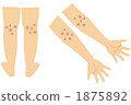 atopic 1875892