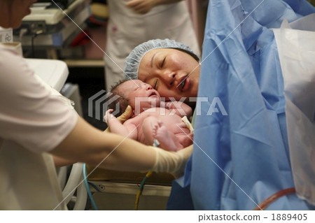 Cesarean section first time parent-child face to face 1889405