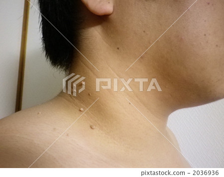 鍋鍋（角質粒） 2036936