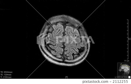 大腦碼頭 2112255