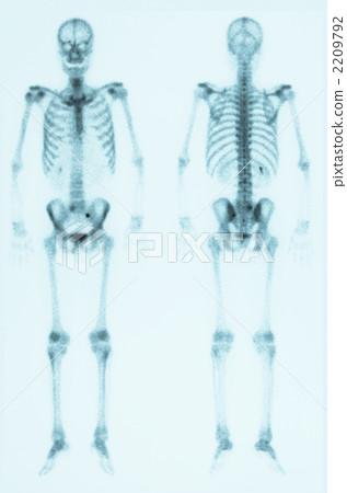 骨閃爍掃描術 2209792