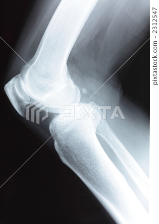 Knee joint side view 2312547
