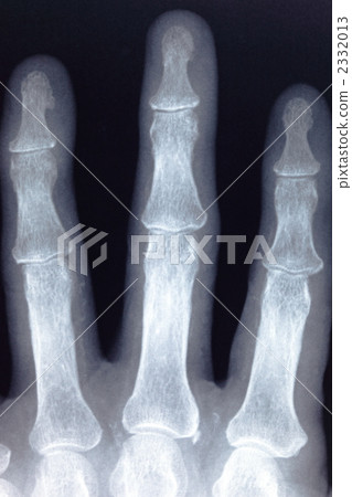手指骨 手指骨 2332013